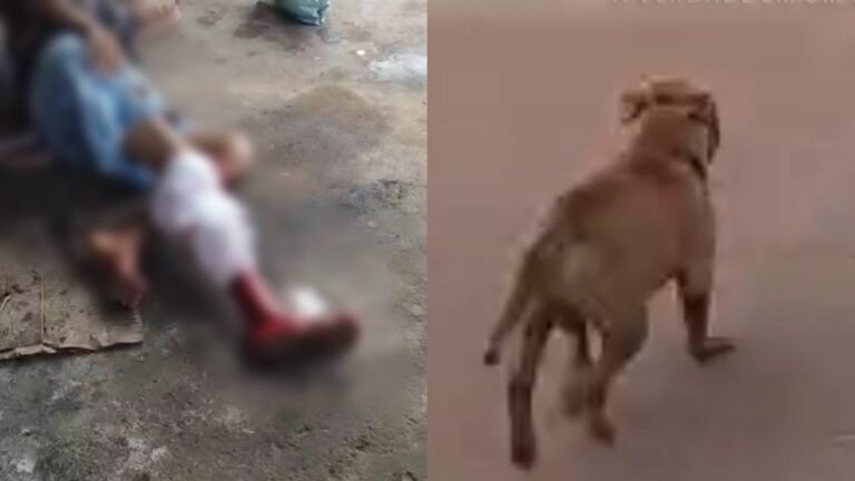 VÍDEO; Jovem fica ferida após ataque de pitbull no bairro São Tomé, em Itaituba