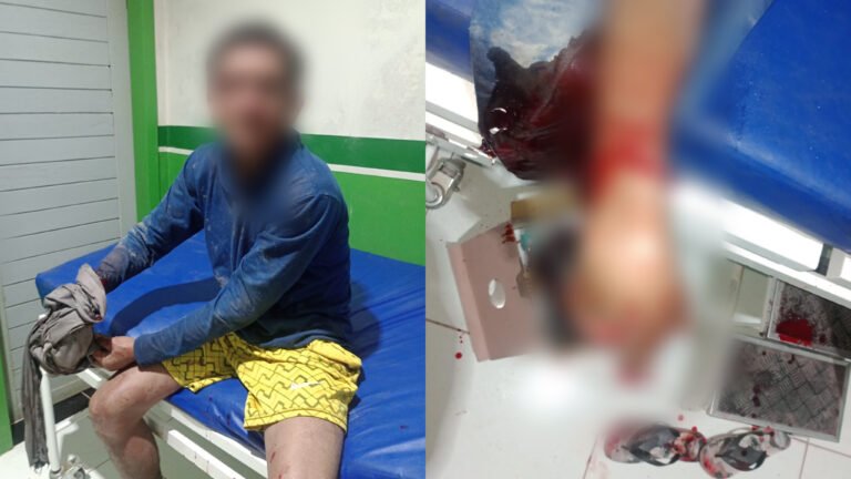 Briga em bar termina com homem ferido a golpes de facão na comunidade do Penedo