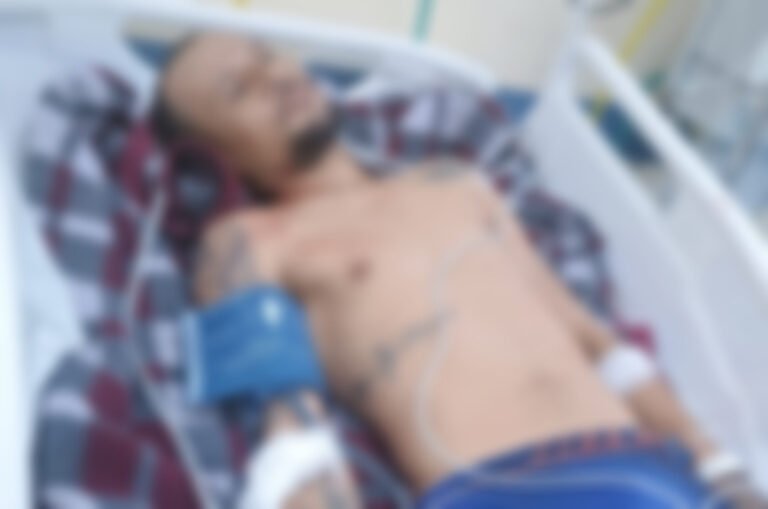 Homem é ferido com golpe de garrafa em estabelecimento e caso é investigado em Itaituba