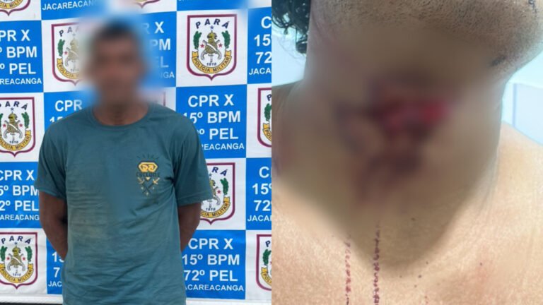Suspeito de esfaqueamento é preso pela PM após vítima dar entrada em hospital de Jacareacanga