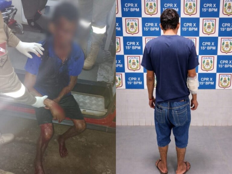Homem de 52 anos é esfaqueado e suspeito é preso pela PM em Itaituba