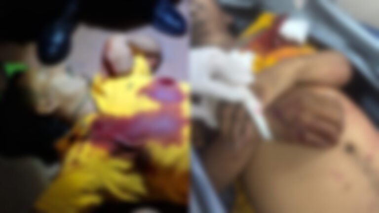 VÍDEO; Homem morre após ser baleado ao lado de um estabelecimento em Itaituba