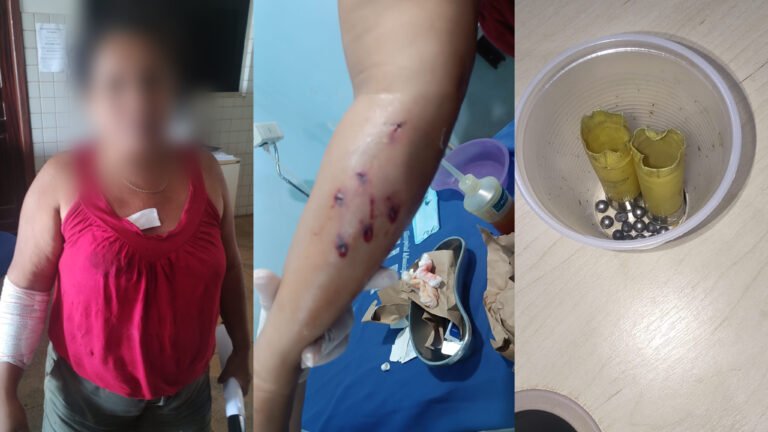 Mulher é baleada pelo cunhado em Trairão; suspeito fugiu para área de mata